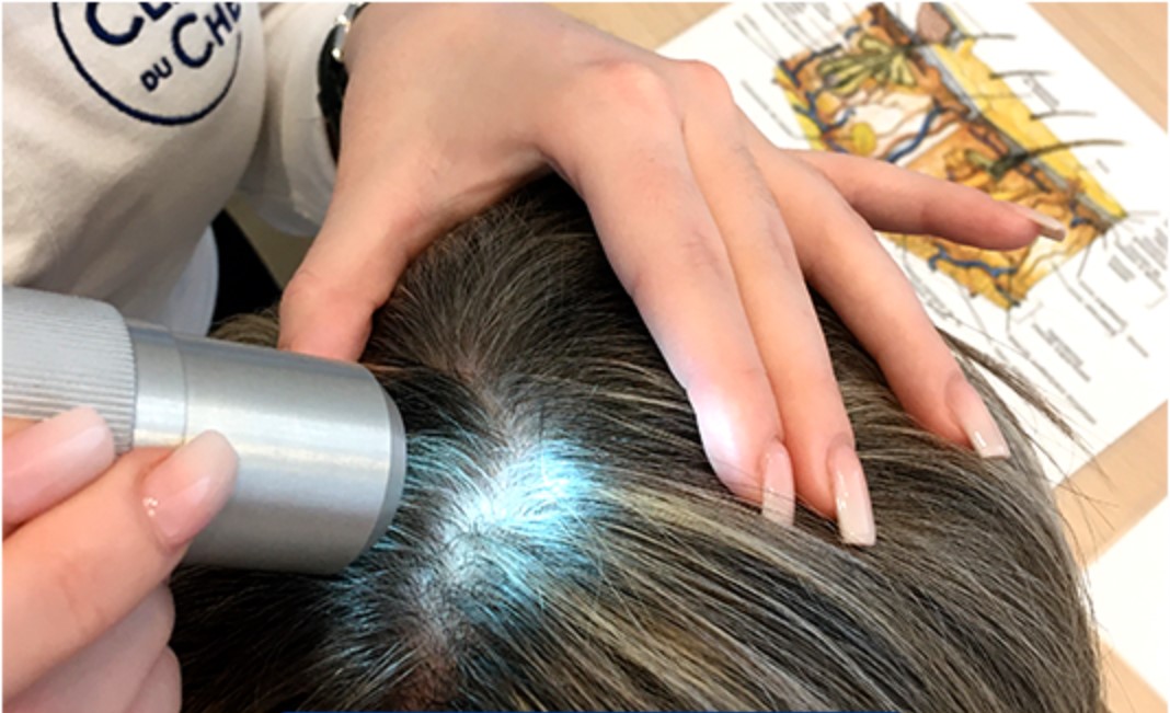 Diagnostic Capillaire